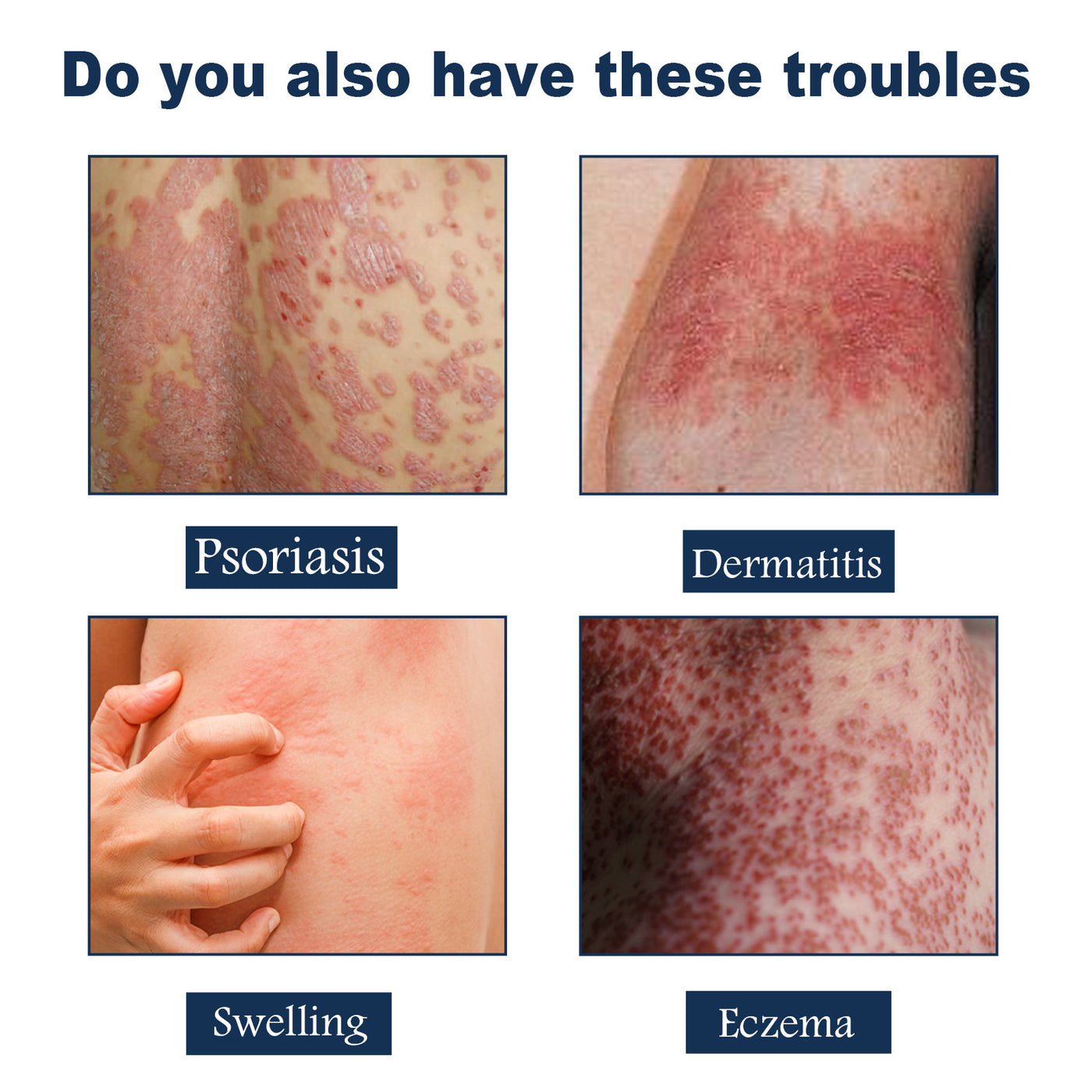 Care Spray Relieves
