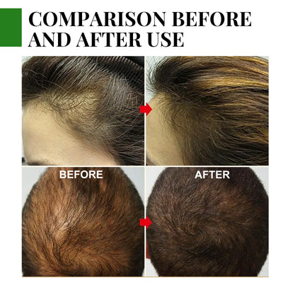 Rosemary Hair Care Essential Oil Anti-loss Hair Scalp Root