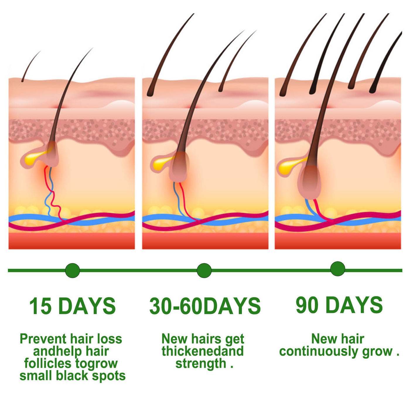 Rosemary Hair Care Essential Oil Anti-loss Hair Scalp Root