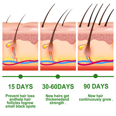 Rosemary Hair Care Essential Oil Anti-loss Hair Scalp Root